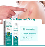 Oveallgo™ Spray avanzado para la eliminación de cicatrices