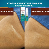 SOUTH MOON-SPRAY PARA CICATRICES
