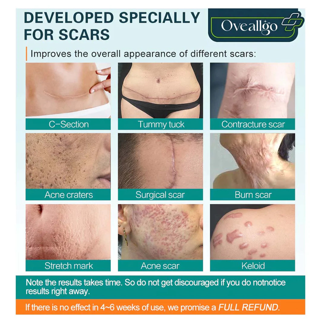 Oveallgo™ Spray avanzado para la eliminación de cicatrices