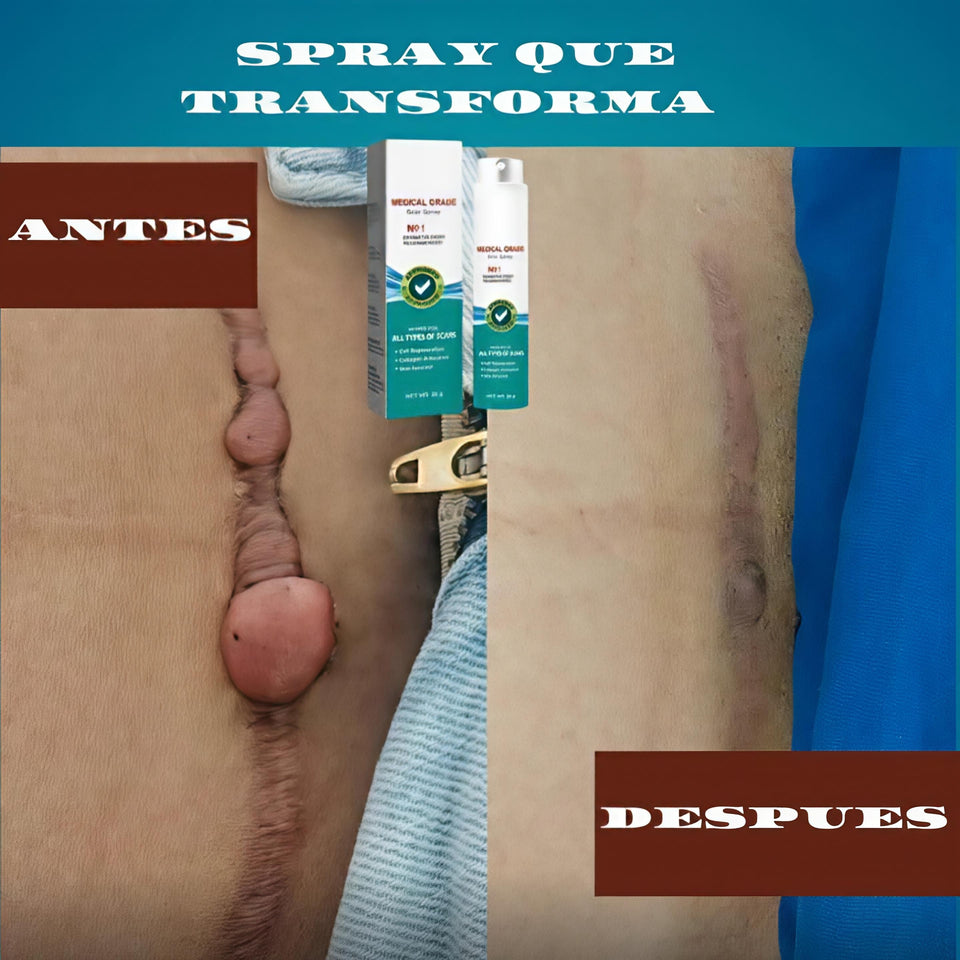 SOUTH MOON-SPRAY PARA CICATRICES